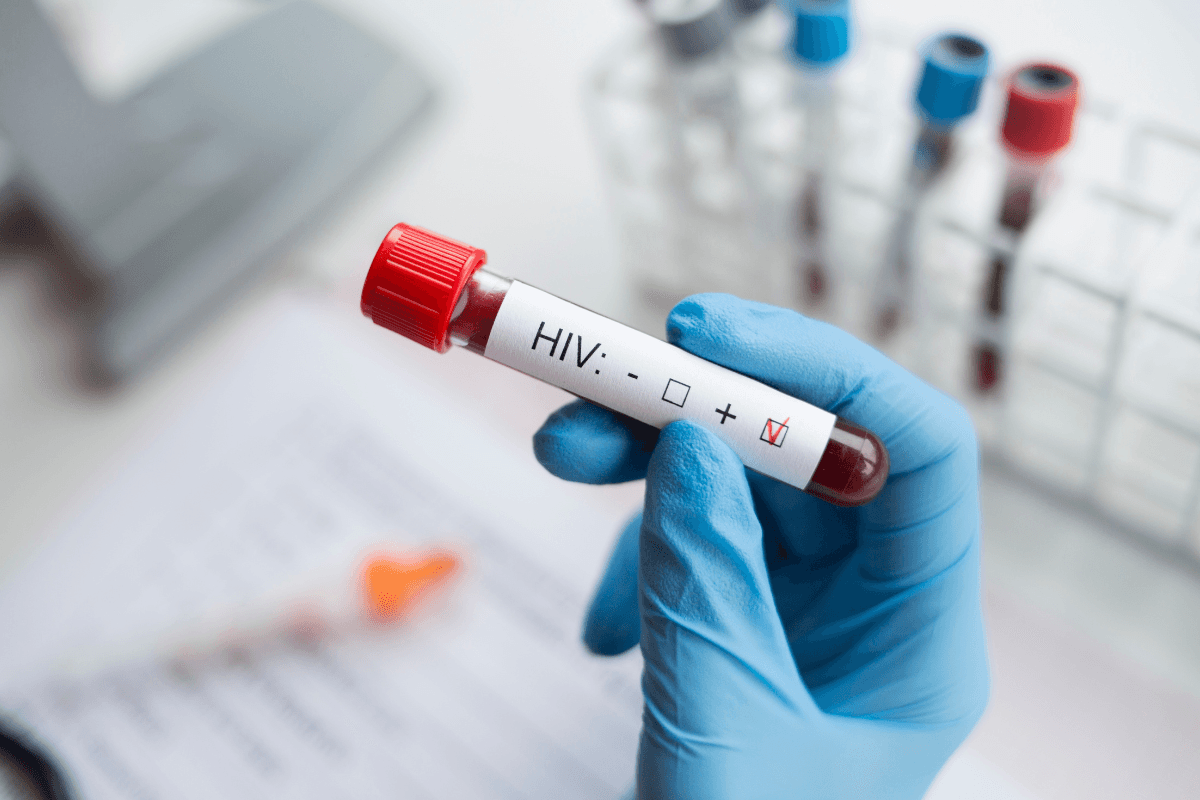 HIV/AIDS Symptoms: Early Signs, Rash Clues, and Testing