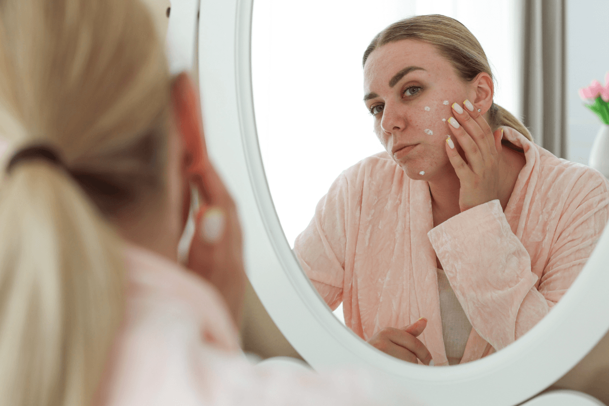 What Helps With Acne Scars? Treatments and Timelines
