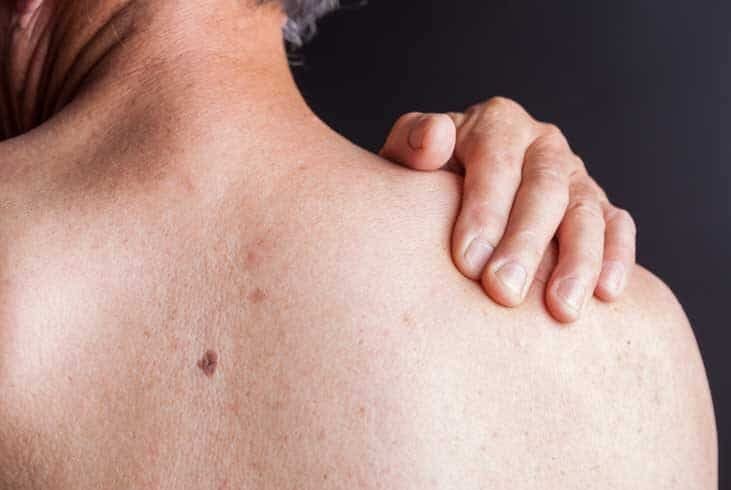 HIV Symptoms in Women: Early Signs, Rash, and Testing Steps