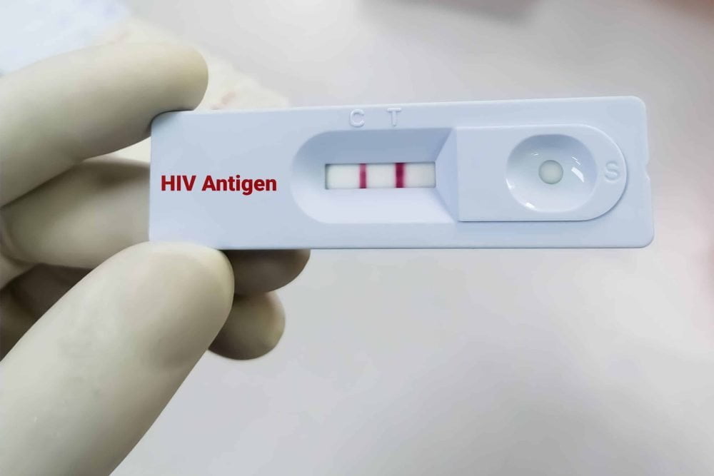 Types of HIV Tests and the Timing That Matters Most