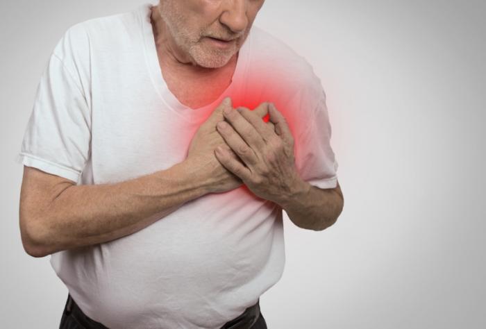 What Is Acute Coronary Syndrome? Symptoms, Types, and Care