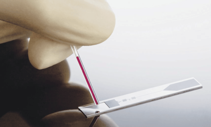How Long Does an HIV Test Take? Windows and Result Timing