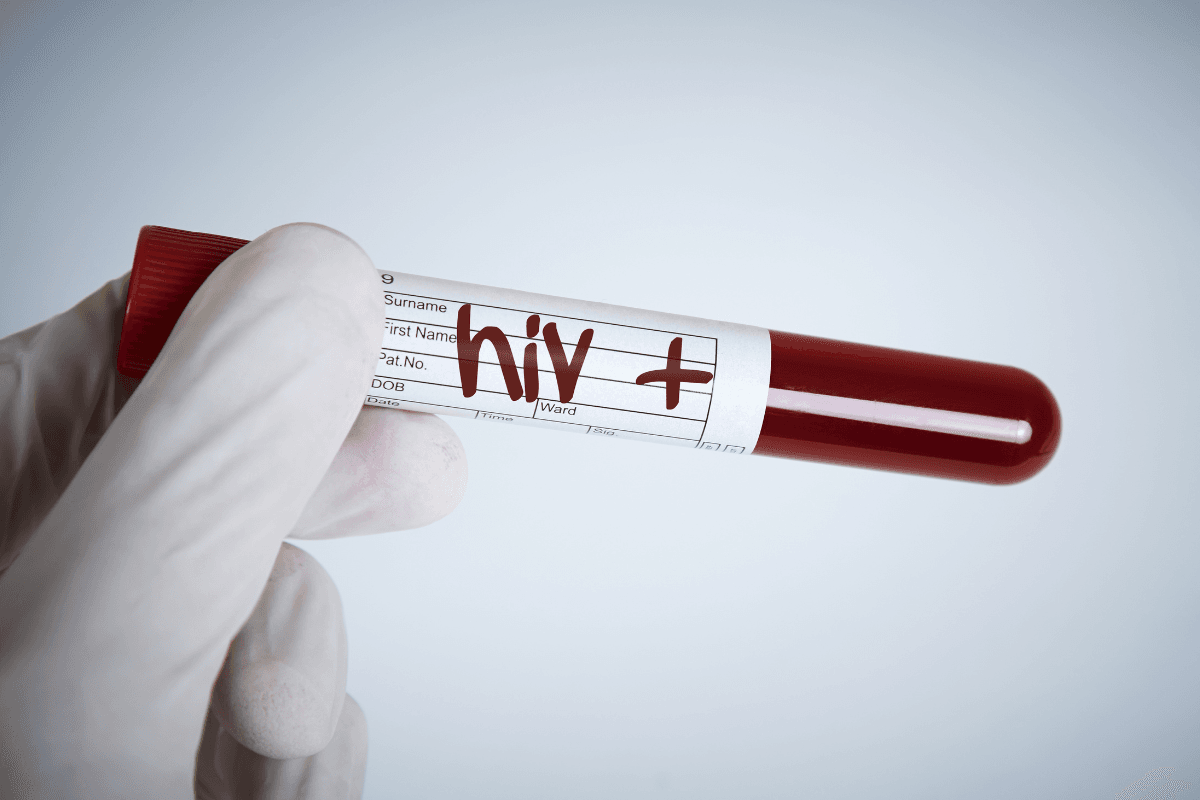 Metformin and HIV Interactions: Safety and Monitoring