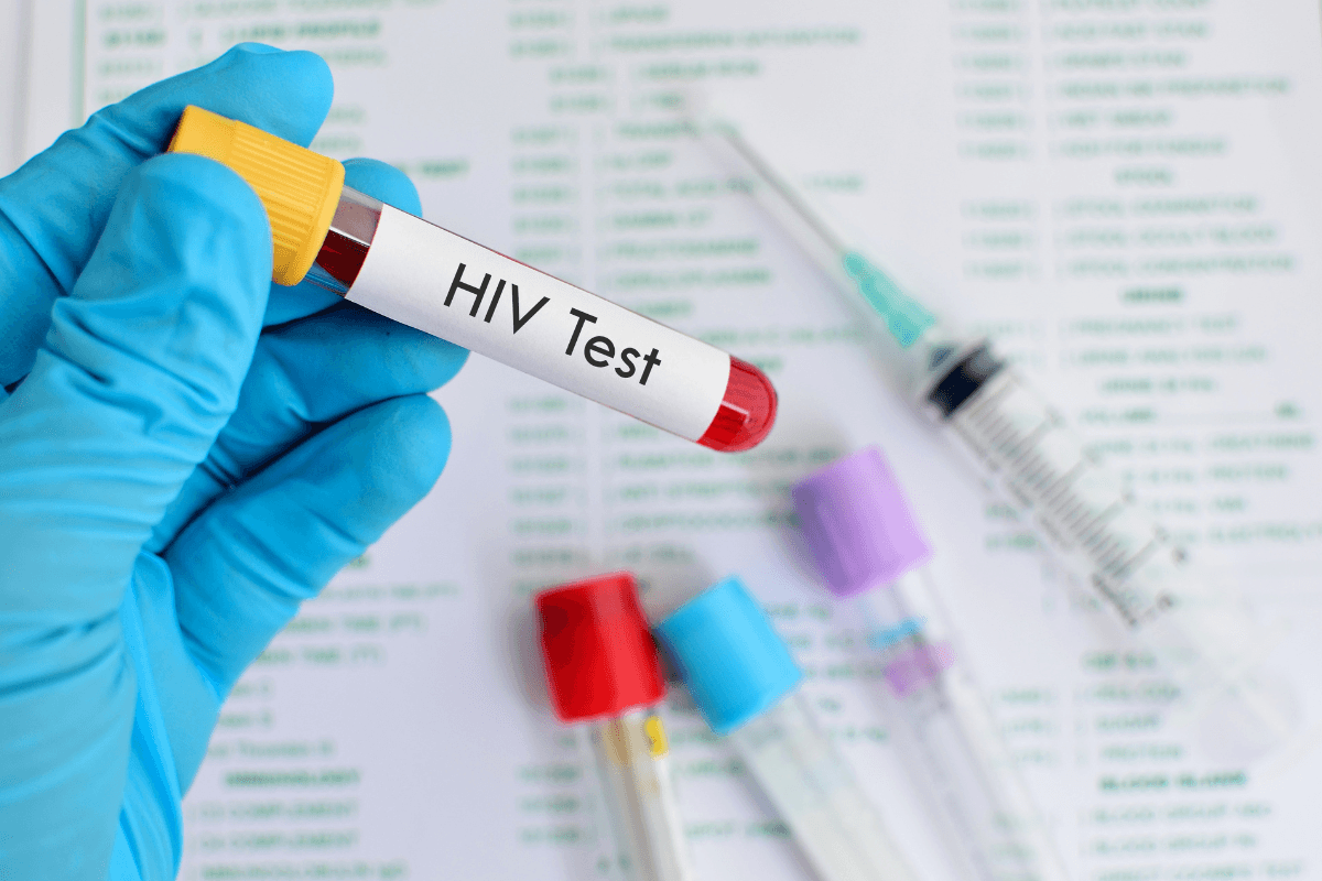 National HIV Testing Day 2025: Testing, Timing, and Support